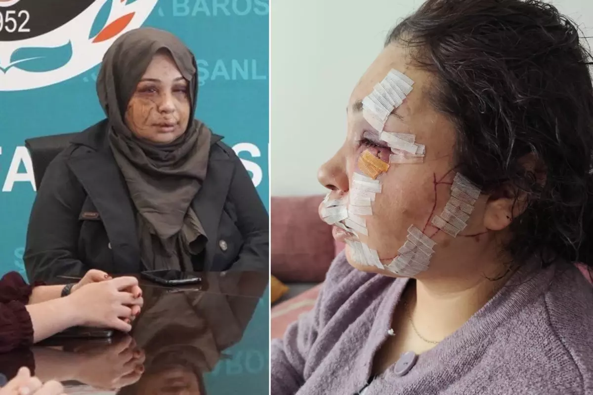 Cumhurbaşkanlığı koruma görevlisi eşine şiddetten tutuklandı