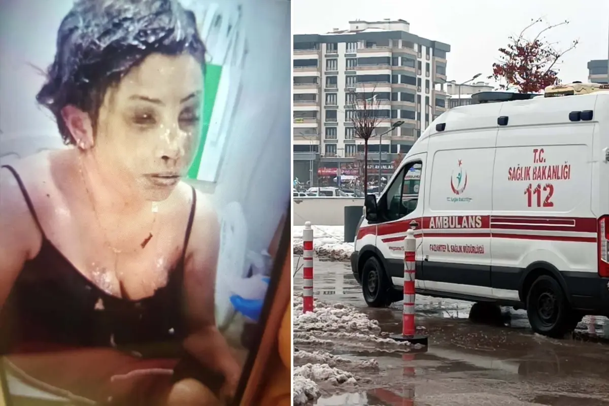 Eşini koli bandıyla bağlayıp kezzapla yaktı