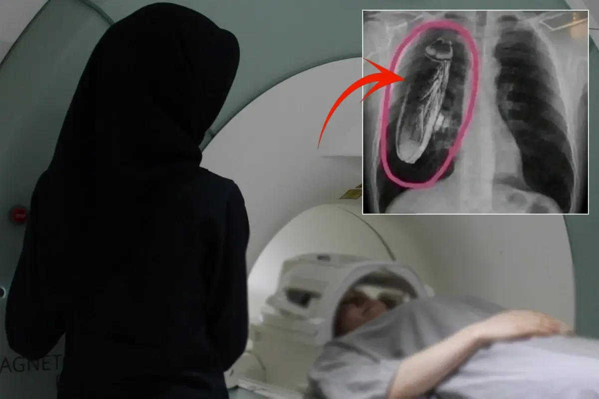 Hastaya "Göğsünde canlı böcek var" teşhisi konuldu, gerçek çok başka çıktı