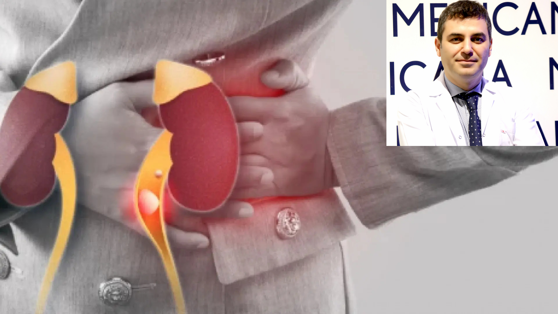 Böbrek taşı riski olanlar Ramazan’da dikkat!