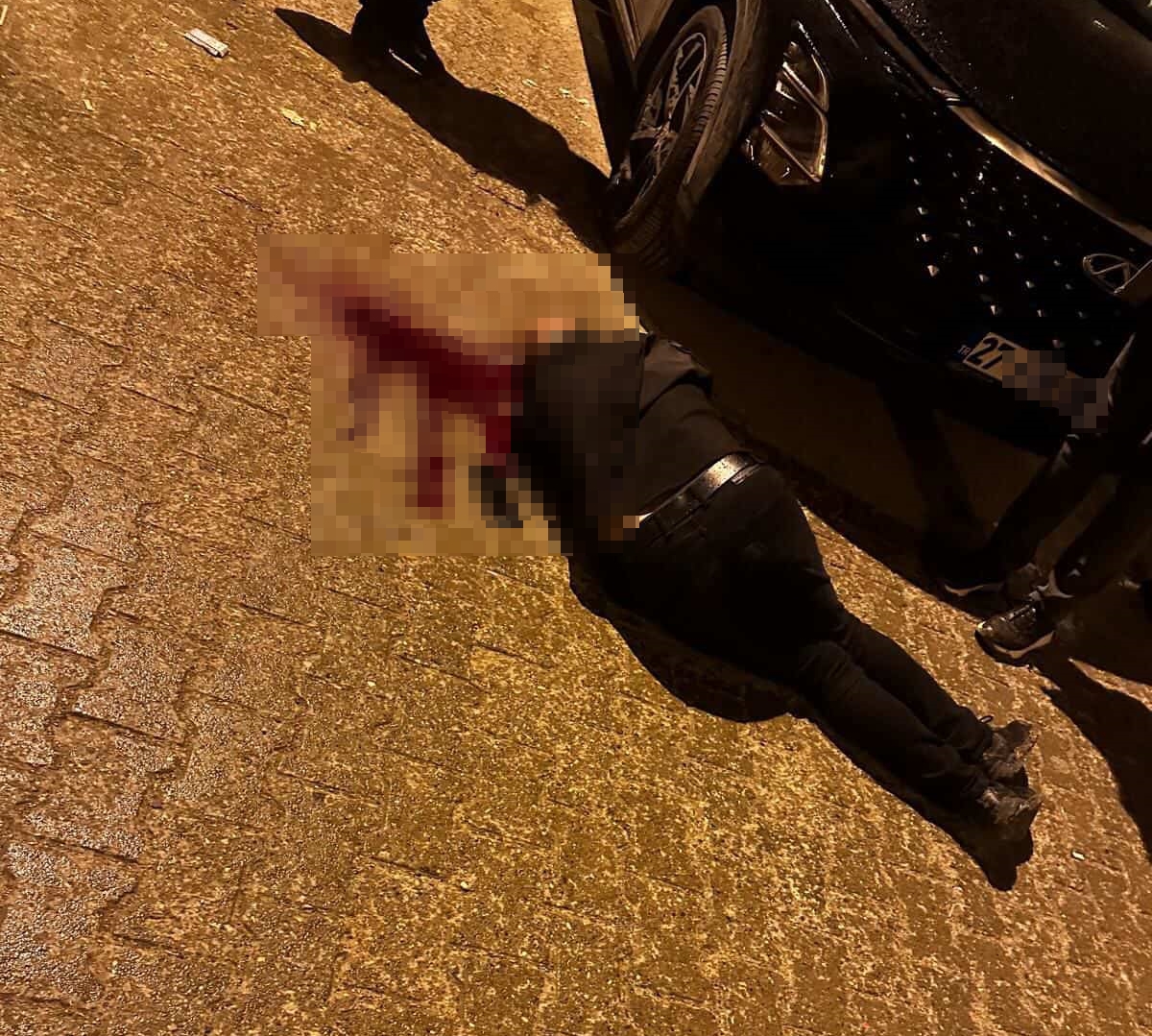 Sokakta yürürken tabanca ile başından vuruldu