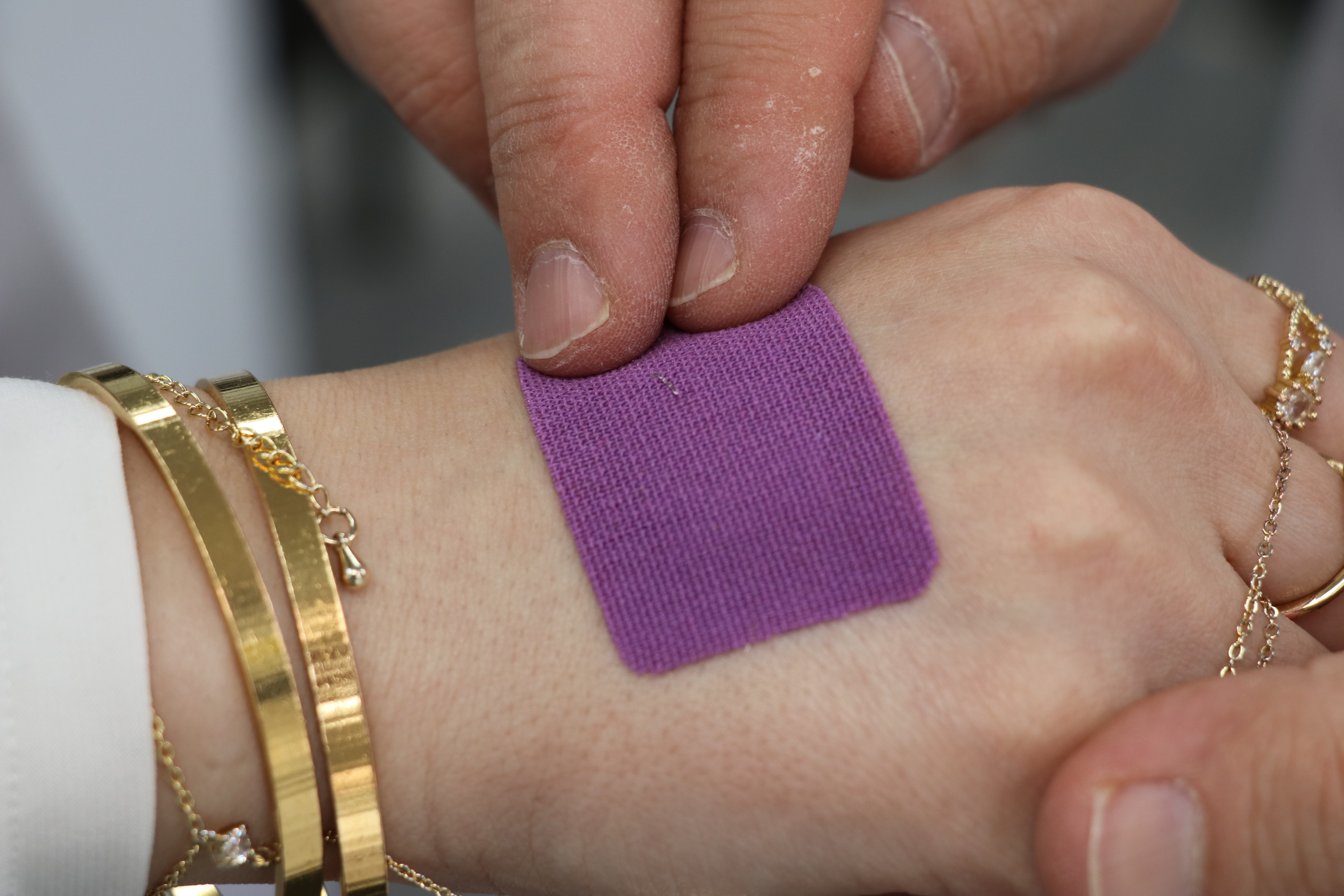 Sivas’ta geliştirilen yerli yara bandı iyileşmeyi hızlandırdı