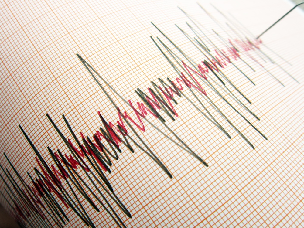 Sivas'ta 3.7 Büyüklüğünde Deprem