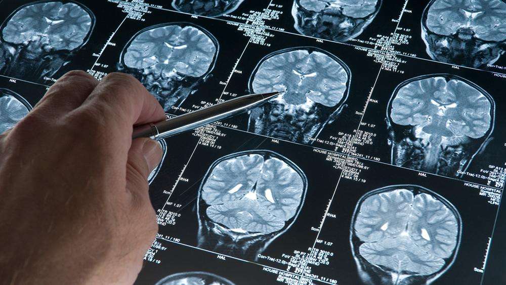 Derin uyku Alzheimer'a karşı koruma sağlayabilir