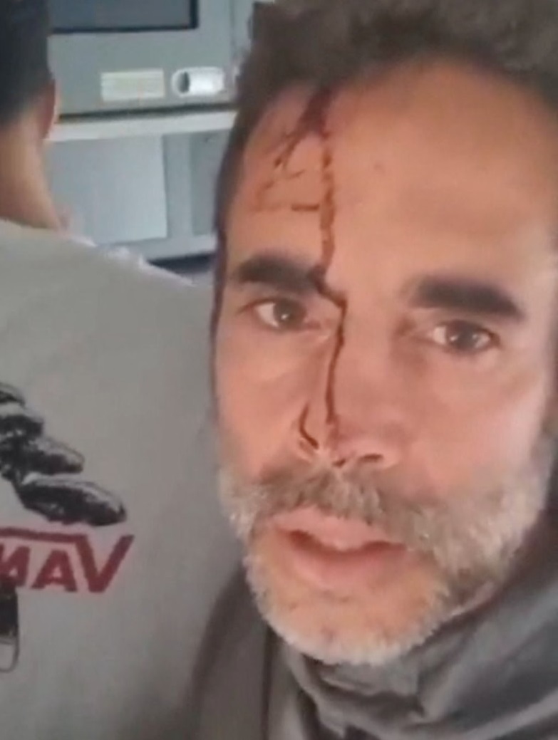 Pilotlar uçakta bıçaklı kavgaya tutuştu