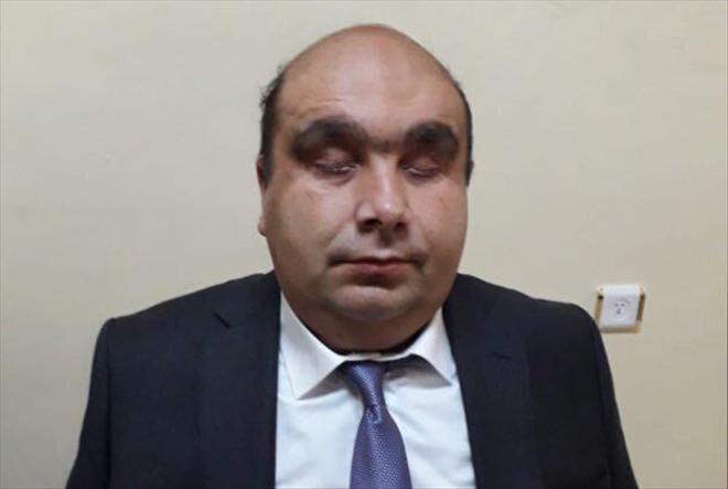 ?ENGELSİZ YARINLAR DİLİYORUZ?