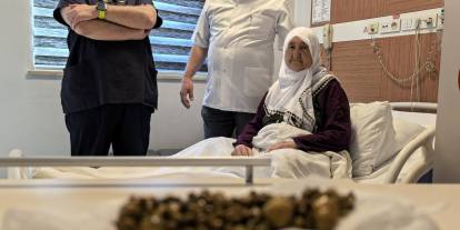 77 yaşındaki kadının safra kesesinden 213 tane taş çıkarıldı