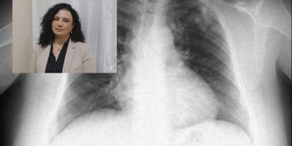 Kış Geldi! Uzmanı Ölümcül Tehlikeye Karşı Uyardı!