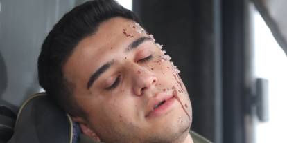 Sivas'tan Ekip Otobüs Kazasında