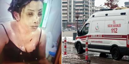 Eşini koli bandıyla bağlayıp kezzapla yaktı