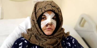 Kadına şiddette sınır tanımadı: Kaldırım taşıyla saldırdı