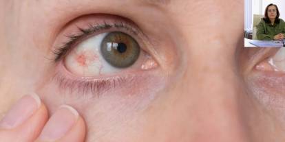 Göz tansiyonu körlüğe giden yolda sessiz bir tehdit