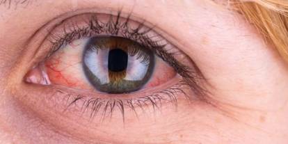 Sağlık Bakanlığı'ndan 'göz tansiyonu' açıklaması