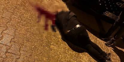 Sokakta yürürken tabanca ile başından vuruldu