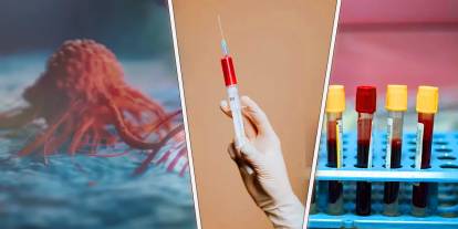 Her yıl 1 milyon kişi ölüyor! Belirti vermeden ilerleyen sinsi hastalık