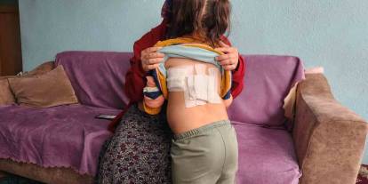 Evinin önünde oynayan çocuğa eşek saldırdı