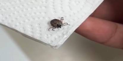 Çocuğun kulağından canlı kene çıkarıldı