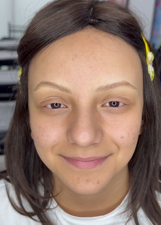 alopesi-hastasi-esma-nurun-kas-hayali-1492273-443949.jpg