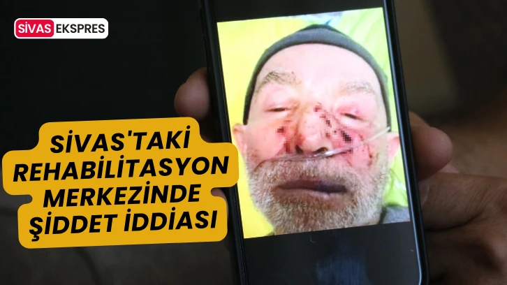 Sivas'taki Rehabilitasyon Merkezinde Şiddet İddiası